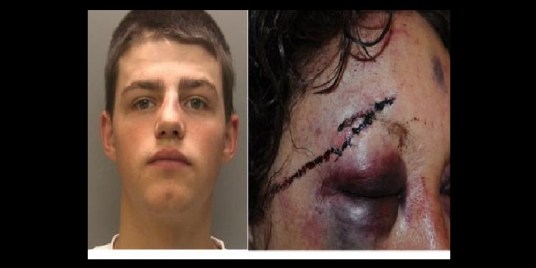 a-18-ans-il-tabasse-et-viole-une-femme-de-58-ans-584919